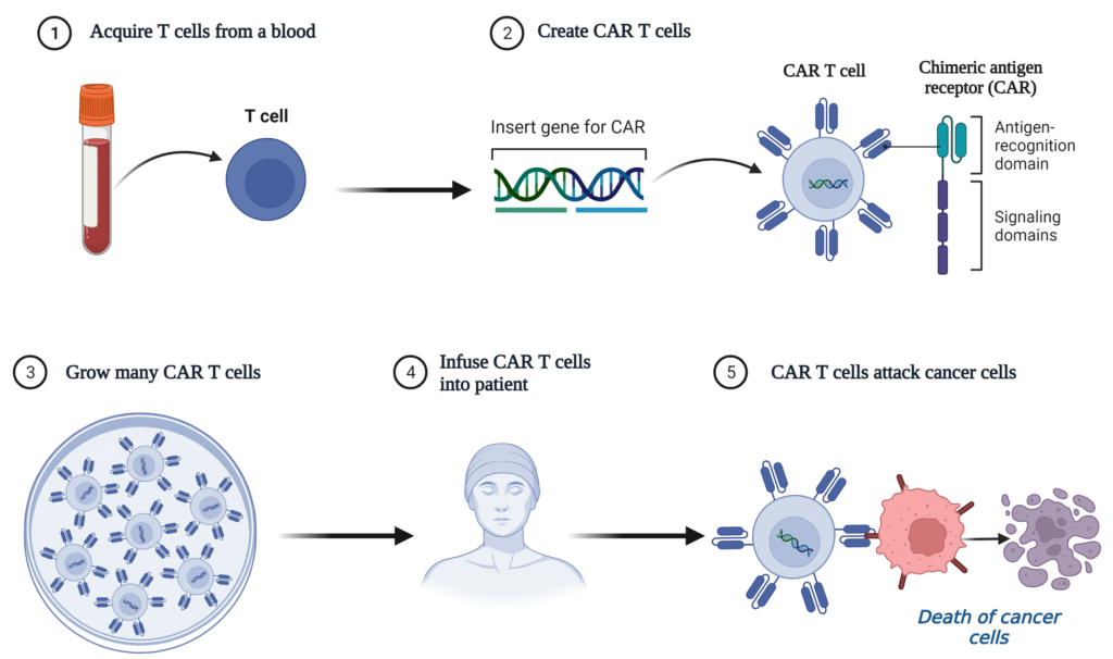 The overall CAR T cell therapy process for treating cancer patients